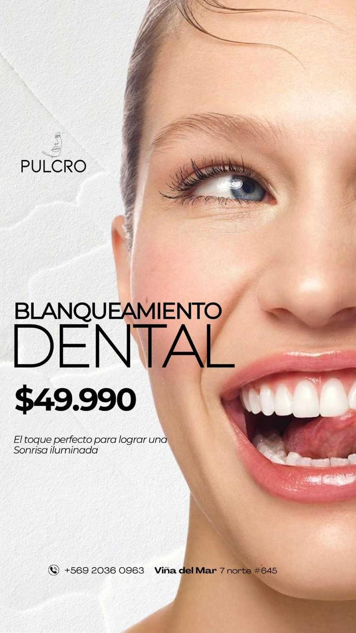 Blanqueamiento Dental · $49.990